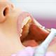 آیا درمان مجدد ریشه دندان عصب کشی شده درد دارد؟